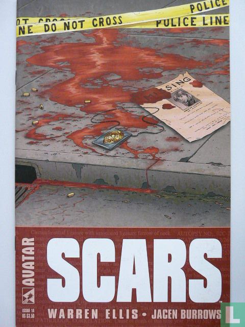Scars
