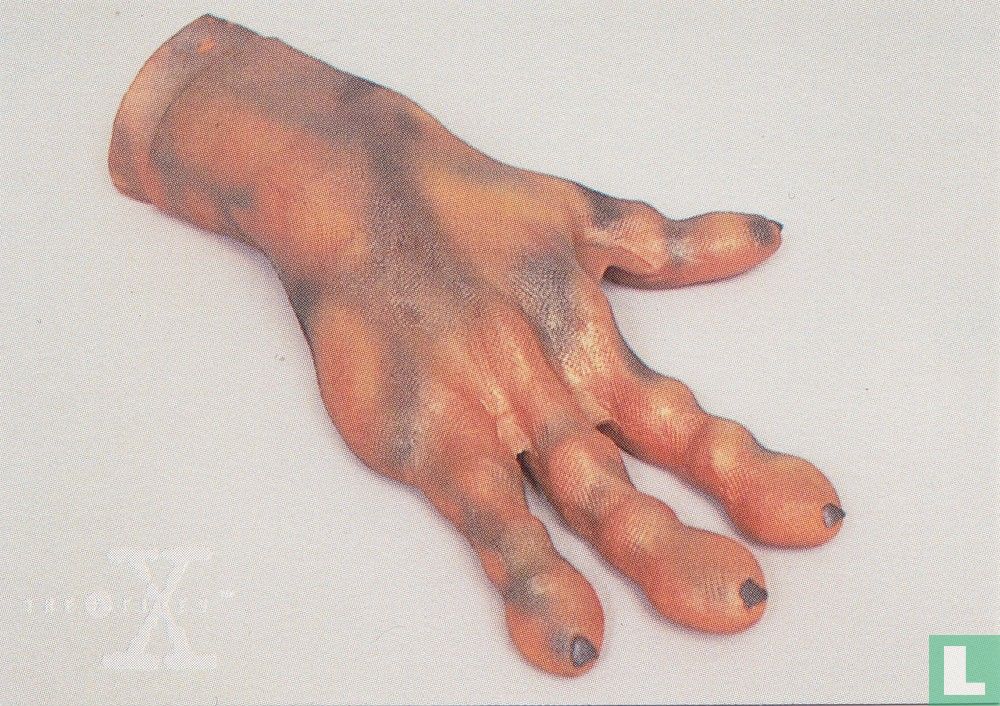 "Salamander hand"