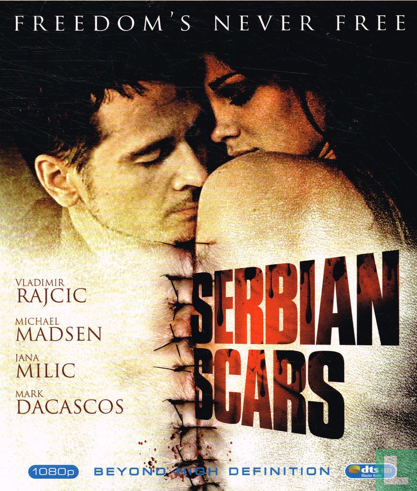 Serbian Scars