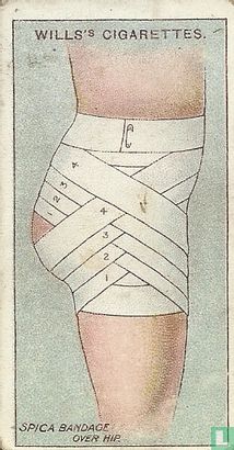 Spica Bandage for Hip - Image 1
