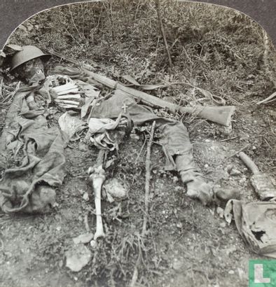 Human wreckage in no man's land, Chemin des Dames, France - Afbeelding 2