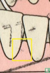 100 jaar tandheelkundig onderzoek (PM2)  - Afbeelding 2