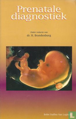 Prenatale diagnostiek - Afbeelding 1