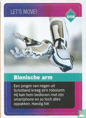 Bionische arm - Afbeelding 1