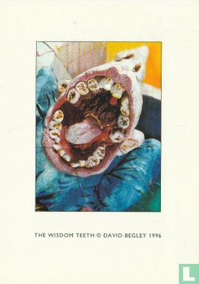 David Begley "The Wisdom Teeth" - Image 1