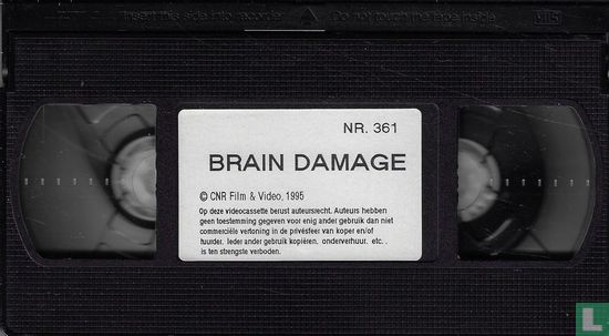 Brain Damage - Image 3