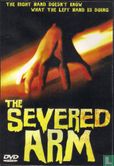 The Severed Arm - Image 1