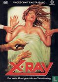 X-Ray - Afbeelding 1