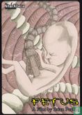 Fetus - Afbeelding 1