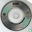The Scabs - Afbeelding 3