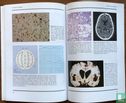 An atlas of Epilepsy - Image 3