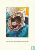 David Begley "The Wisdom Teeth" - Afbeelding 1