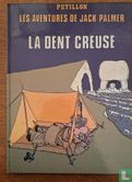 La dent creuse