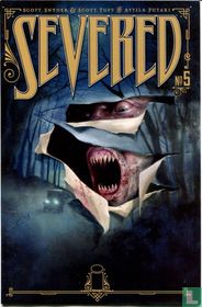Severed